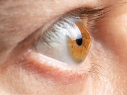 Cornea and ocular surface diseases