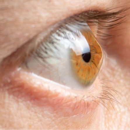 القرنية وأمراض سطح العين