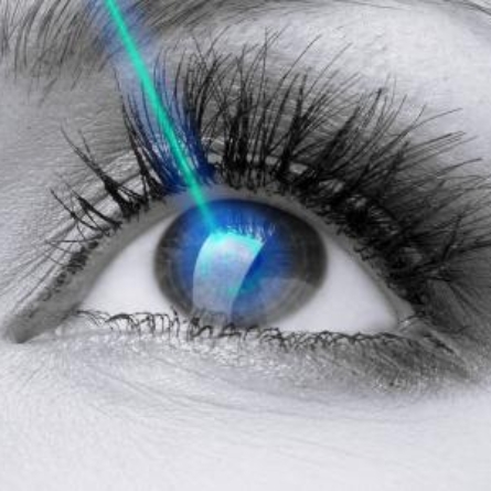 تصحيح_النظر_بالليزر