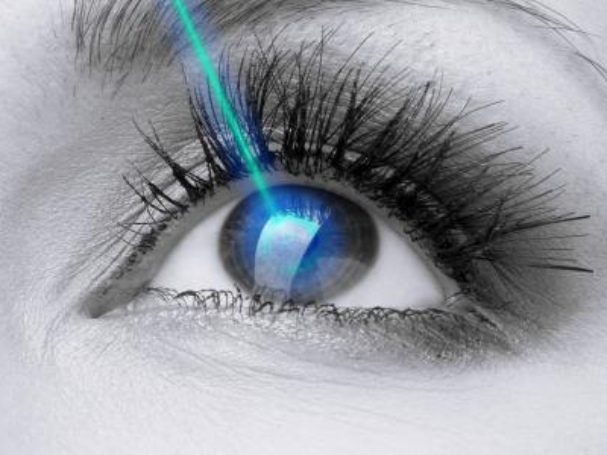 تصحيح_النظر_بالليزر