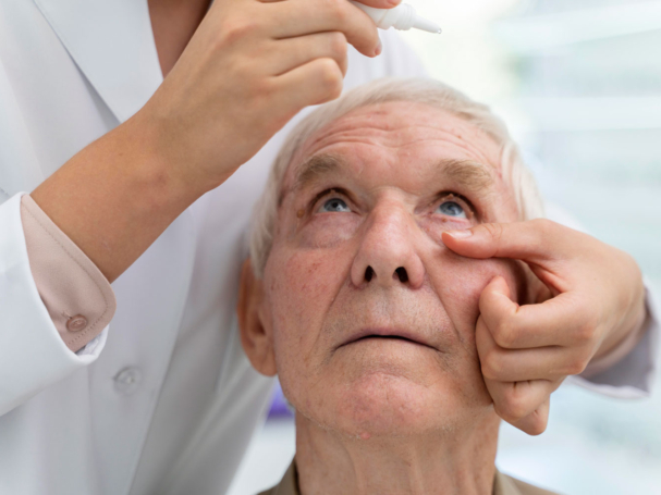 علاج المياه الزرقاء في العين - الجلوكوما