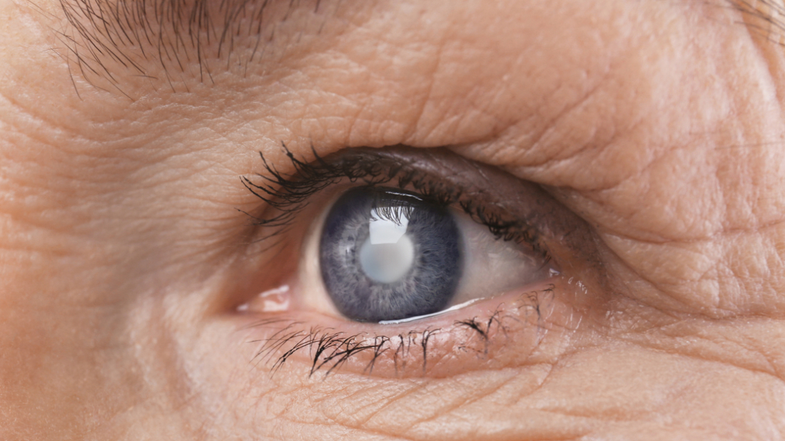 أفضل دكتور مياه بيضاء في مصر