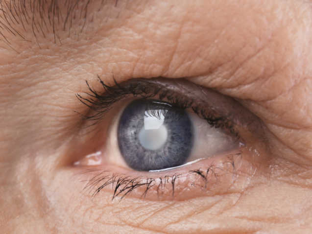 أفضل دكتور مياه بيضاء في مصر