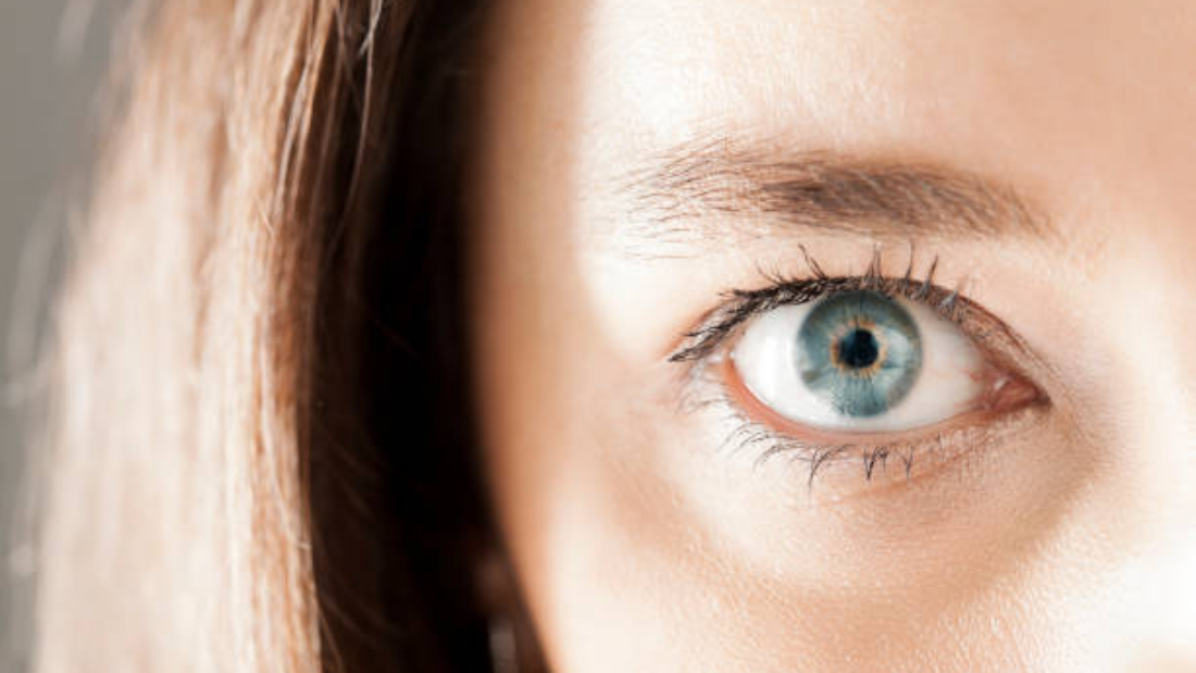 تجربتي مع المياه البيضاء