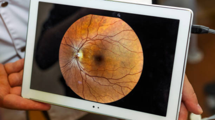 حقن الشبكية لمرضى السكري